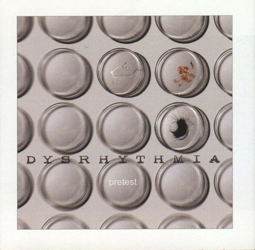 Dysrhythmia pretest - pretest, 2003)